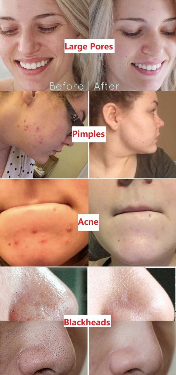 Diystar™  Green Tea Deep Cleanse Mask Stick