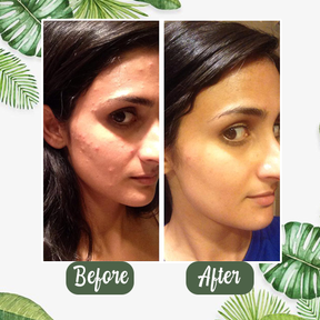 Diystar™  Green Tea Deep Cleanse Mask Stick