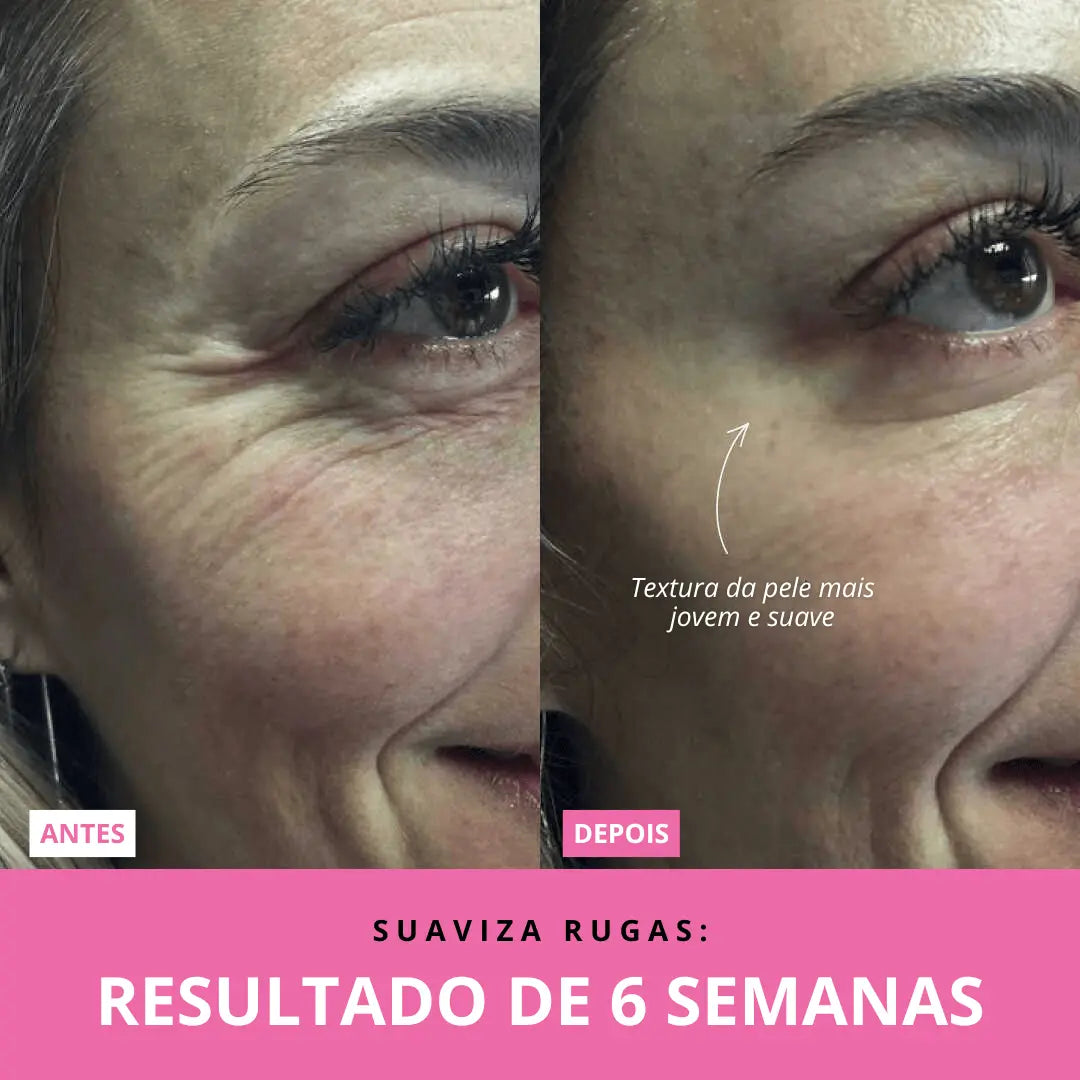 Aurea Glow™ | Rejuvenescedor Facial LED + Sérum GRÁTIS