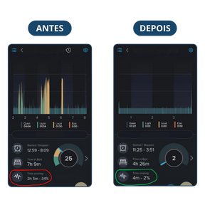 Protetor Bucal Anti-Ronco Znorex®